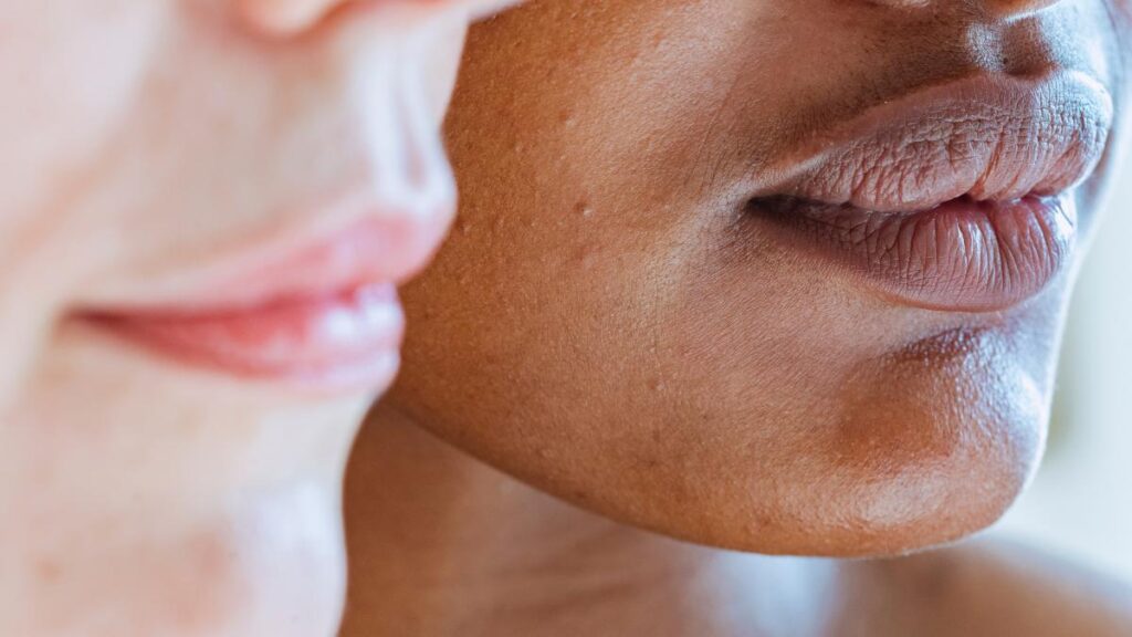 Parte inferior do rosto de duas pessoas, mostrando as texturas das peles.